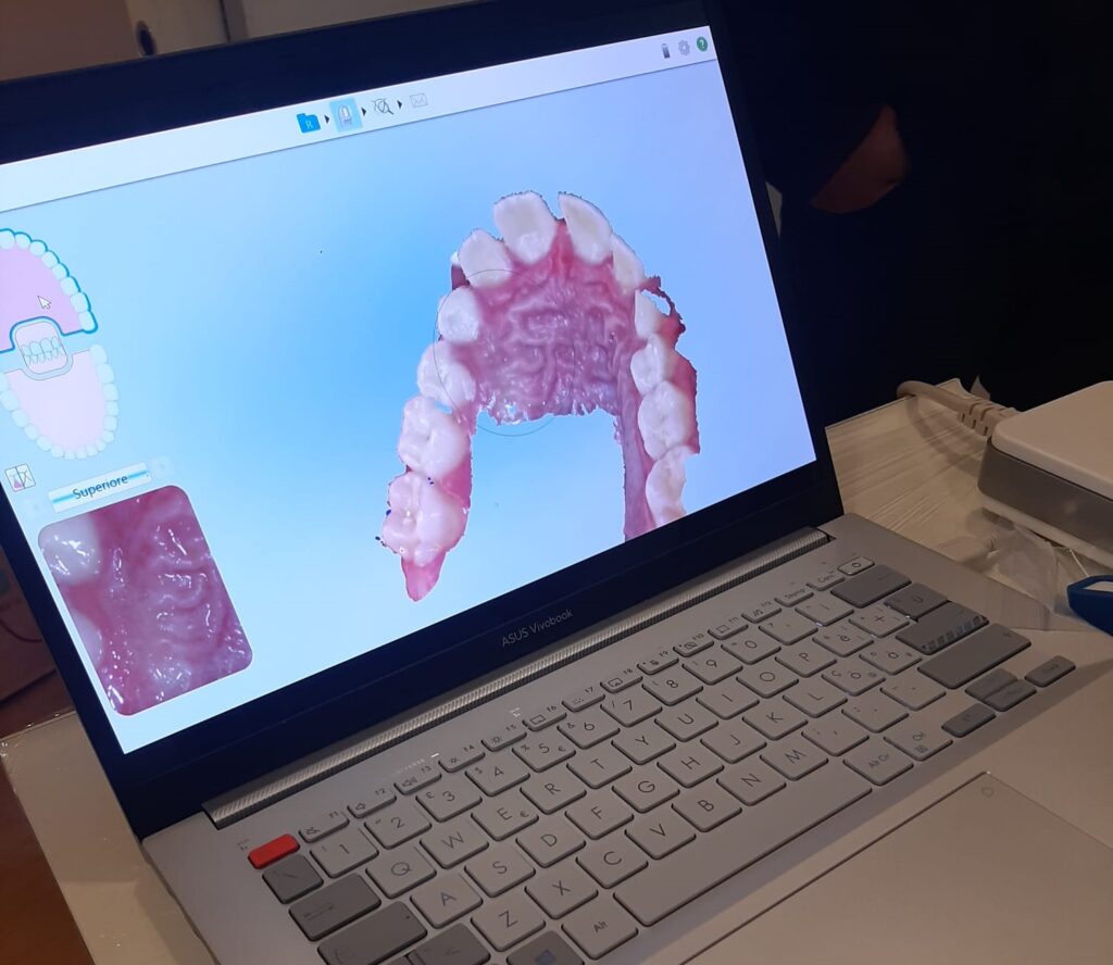 scanner-intraorale-modello-3D-denti-dentista-sainati-pisa