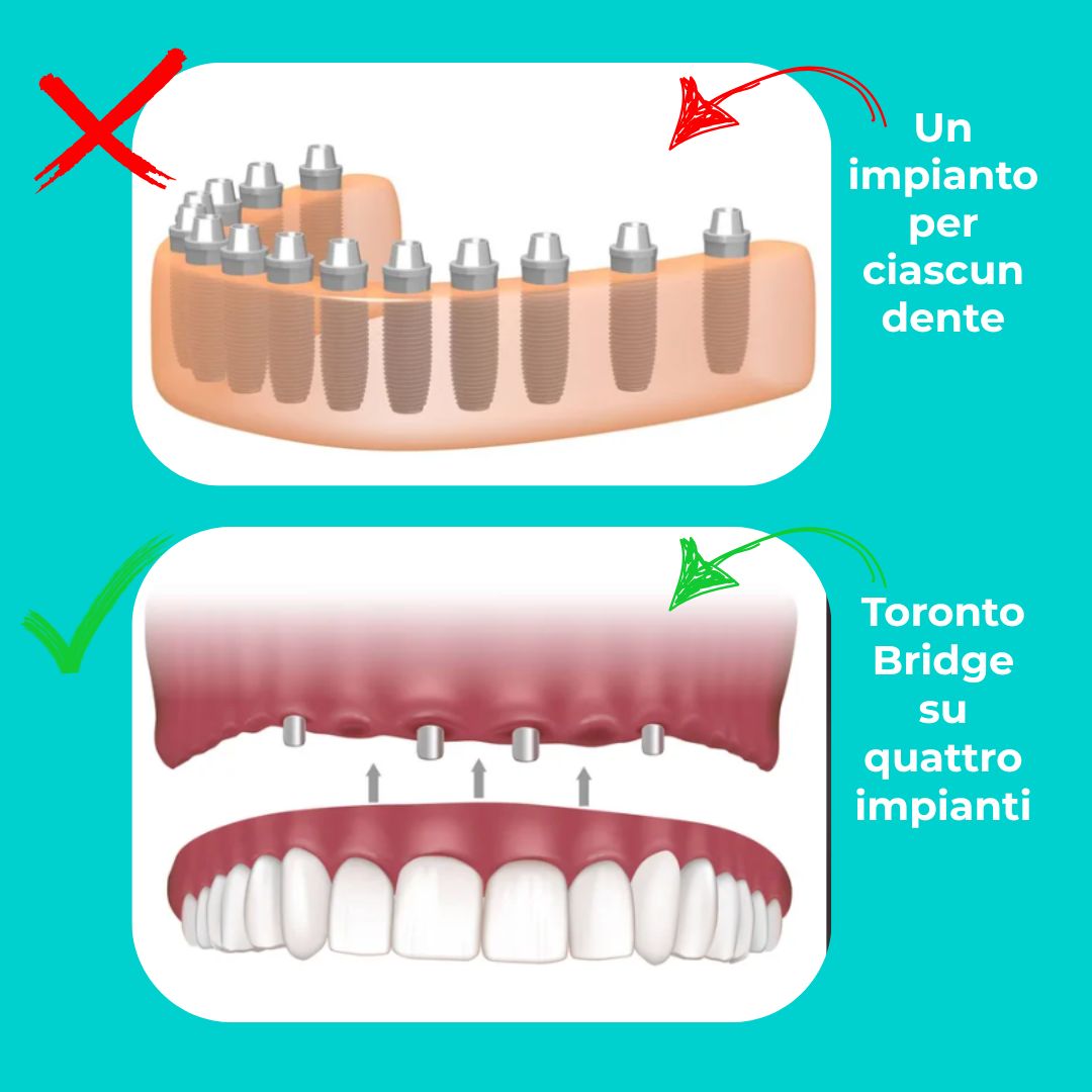 Strumento Dentale Intagliatore/conciatore #4 &ndash; Acciaio Inox Tedesco, Surginstruments, Per Laboratorio Odontotecnico